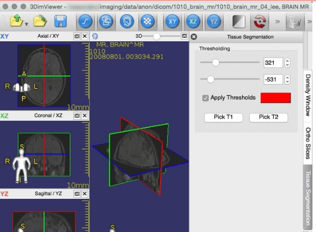 sante free dicom viewer