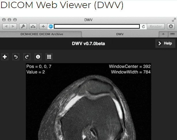 Dicom Web Viewer
