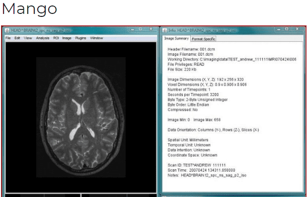 Mango Dicom Image viewer